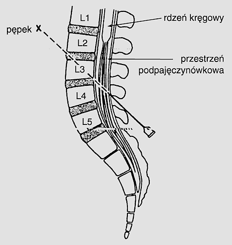 img10369_punkcja3.gif