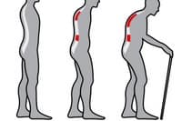 Osteoporoza u chorych na POChP