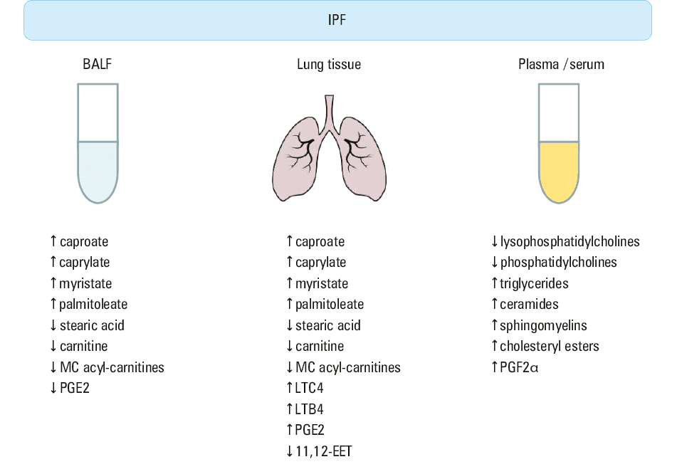 Lipids / lipid-loaded cells in semifibrotic regions in an IPF-affected lung; A – overlay scan of confocal transmitted lasers (670 nm, 540 nm, and 476 nm). Lipids were detected using Sudan IV dye (reddish color indicated by arrow heads); B – second harmonic generation (SHG) and autofluorescence (500–700 nm), derived from 2-photon excitation at 860 nm. Collagen fibers were detected using SHG (cyan spots). Autofluorescence is depicted in magenta. C – overlay of A and B. Arrow heads indicate overlap of lipid staining and autofluorescence.  Abbreviations: see Figure 1
