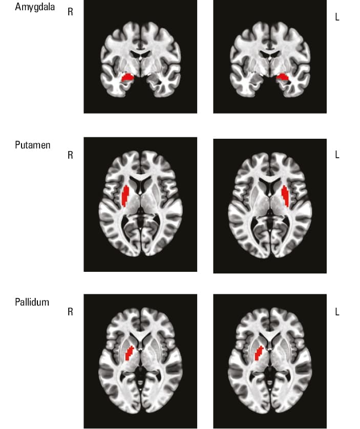Results of the region-of-interest analysis (based on the Harvard–Oxford atlas); 0 seconds on the X axis refers to the start of the Valsalva maneuverAbbreviations: BOLD, blood oxygen level–dependent