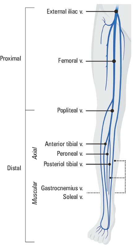Proposed therapeutic approach to isolated distal deep vein thrombosisAbbreviations: CUS, compression ultrasonography; others, see Table 1