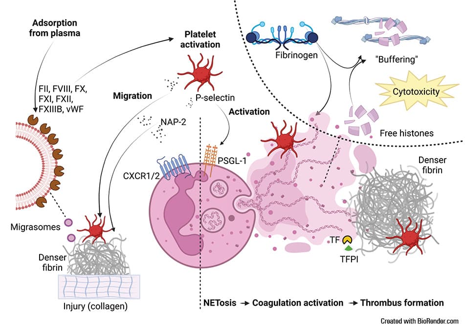 Pathological transformation of fibrinogen to amyloid fibrin (fibrinaloid) in response to lipopolysaccharides (LPS), contributing to persistent clot formation and potential complications in conditions associated with inflammation and infection. The microclot was observed within a fibrin clot prepared from plasma of a patient with acute pulmonary embolism and visualized using scanning electron microscopy.