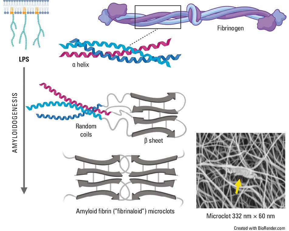 Atypical fibrin fibers observed within a fibrin clot prepared of plasma obtained from a patient with type I antithrombin deficiency (A) and normal fibrin fibers of a healthy control with a similar fibrinogen level (B).Fibrin clots were visualized using scanning electron microscopy (magnification ×10 000; scale bar 2 µm).