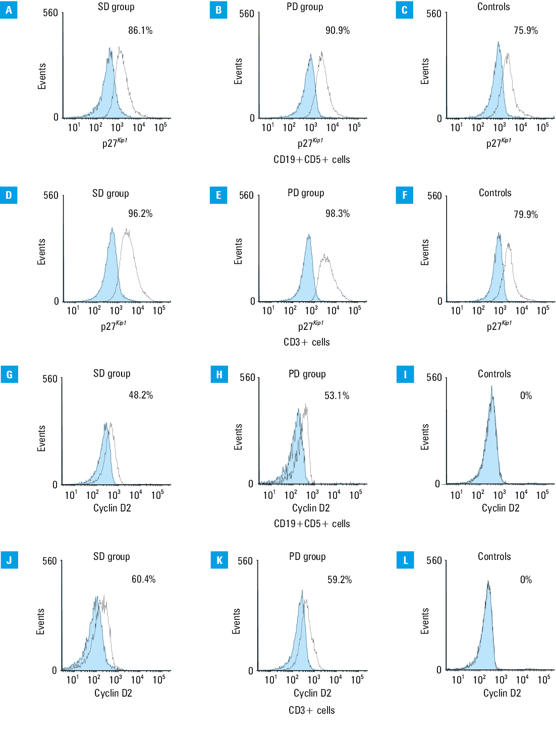 Cumulative probability of progression-free survival in the patients with chronic lymphocytic leukemia stratified according to the rate of apoptosis (A, B) and cyclin-dependent kinase inhibitor 1B (p27Kip1) protein (C, E) and cyclin D2 (D, F) expression. The patients with high and low rate of apoptosis or expression of p27Kip1 and cyclin D2 were identified as >median and ≤median values, respectively. P values were obtained from the log-rank test. Hazard ratios (HRs) with 95% CIs are shown for each comparison.