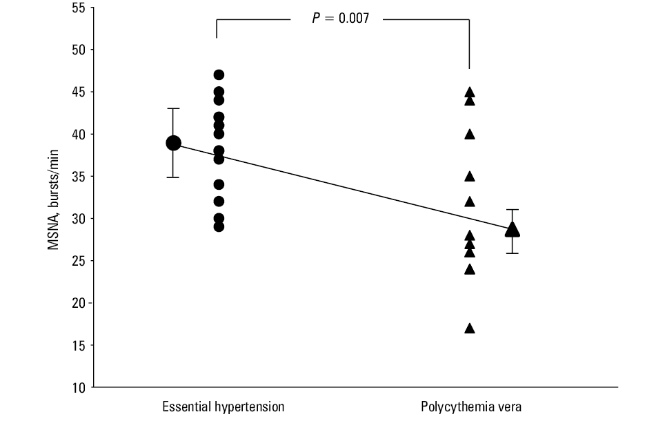 Traces of muscle sympathetic nerve activity (MSNA; neurogram) and electrocardiography in a patient with polycythemia vera (A) and in a patient with essential hypertension (B)Abbreviations: BP, blood pressure; HR, heart rate
