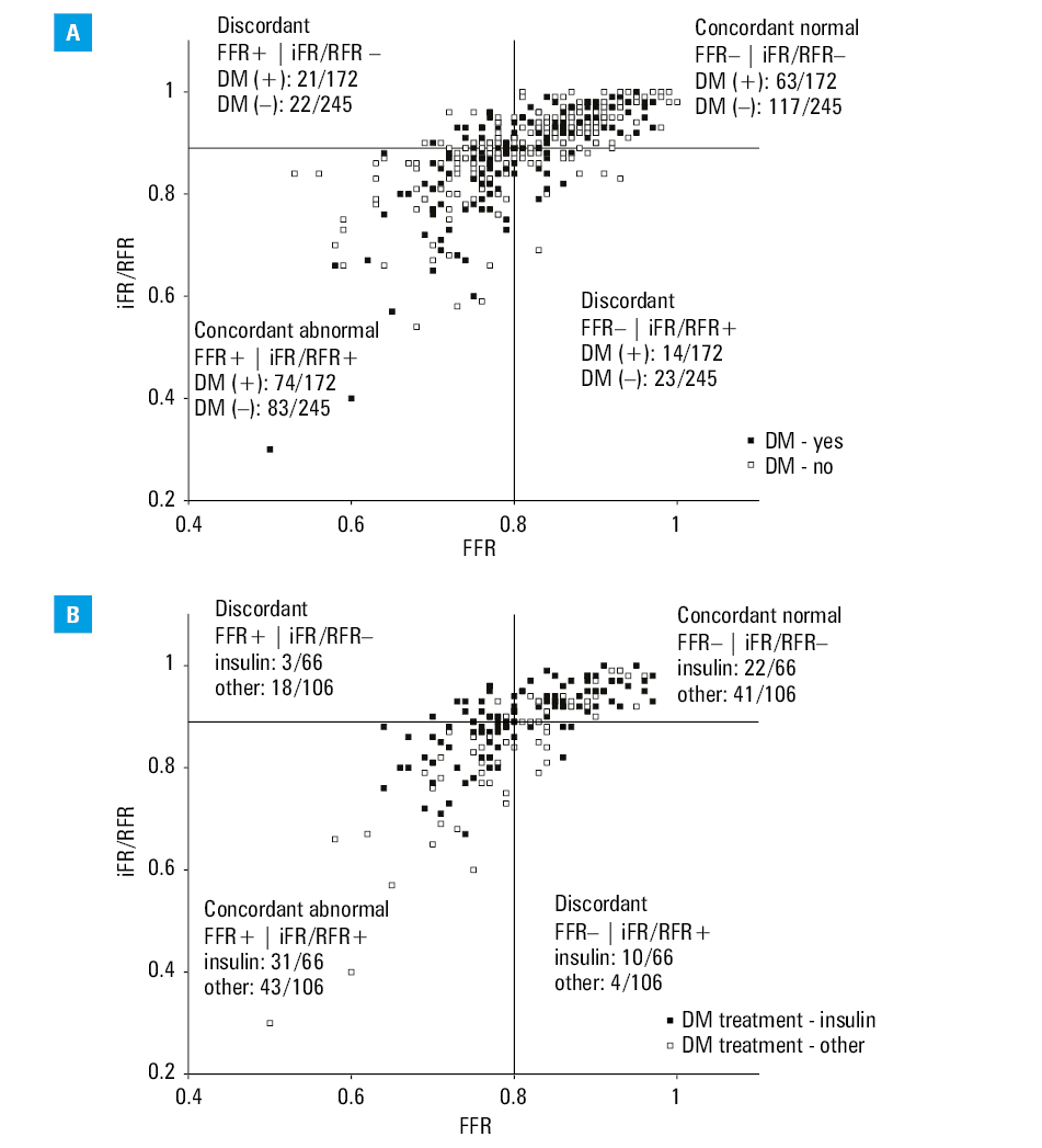 Receiver operating characteristic curves: classification accuracy of fractional flow reserve (A) and instantaneous wave-free ratio / resting full-cycle ratio (B)Abbreviations: see Table 1 and Figure 1