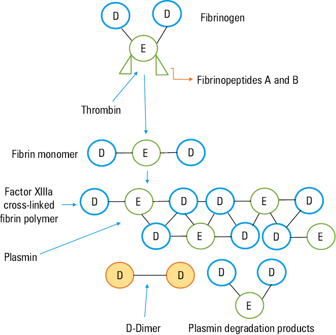 Diagnostic algorithm for suspected PE (first episode and recurrent)Wells score for PE: signs and symptoms of DVT: 3 points, alternative diagnosis less likely: 3 points, tachycardia: 3 points, recent immobility or surgery: 1.5 points, previous DVT and / or PE: 1.5 points, hemoptysis: 1 point, active cancer: 1 point. Score above 6: high probability; score 2–6: intermediate probability; score below 2: low probabilityModified Geneva score for PE: age above 65 years: 1 point, previous DVT or PE: 3 points, surgery or fracture within 1 month: 2 points, active cancer: 2 points, unilateral lower limb pain: 3 points, hemoptysis: 2 points, heart rate of 75 to 94 bpm: 3 points, heart rate of 95 bpm or more: 5 points, pain on lower-limb deep venous palpation and unilateral edema: 4 points. Score above 11: high probability (prevalence of 74%), score 4–10: intermediate probability (prevalence of 28%); score 0–3: low probability (prevalence of 8%)Abbreviations: CTPA, computed tomography pulmonary angiography; DVT, deep vein thrombosis; PE, pulmonary embolism; PTP, pretest probability