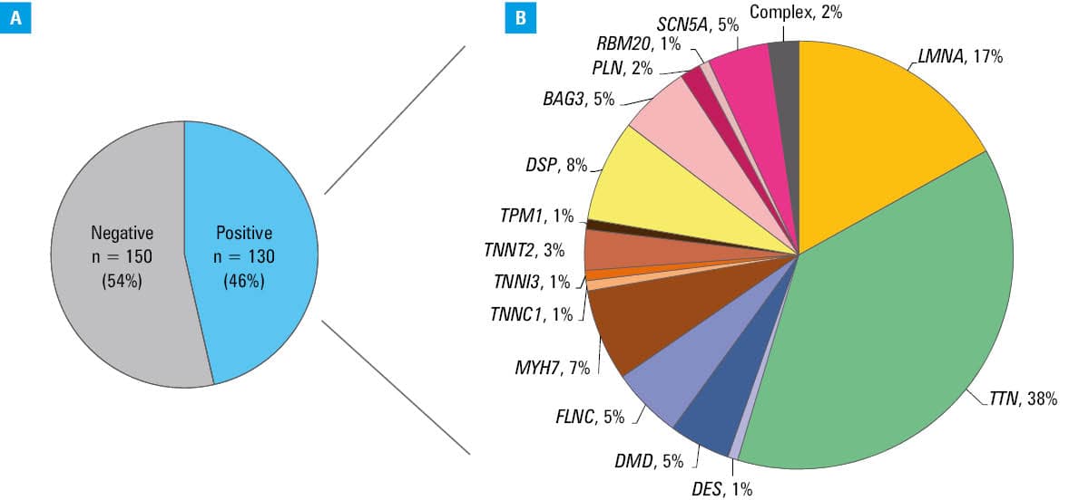 Severe dilated cardiomyopathy (DCM)-free survival according to genetic background; A – gene-positive vs gene-negative DCM; B – DCM related to variants in the TTN gene (group 1), LMNA gene (group 2), other genes (group 3), and gene-negative DCM (group 0)Abbreviations: HR, hazard ratio; others, see Table 1